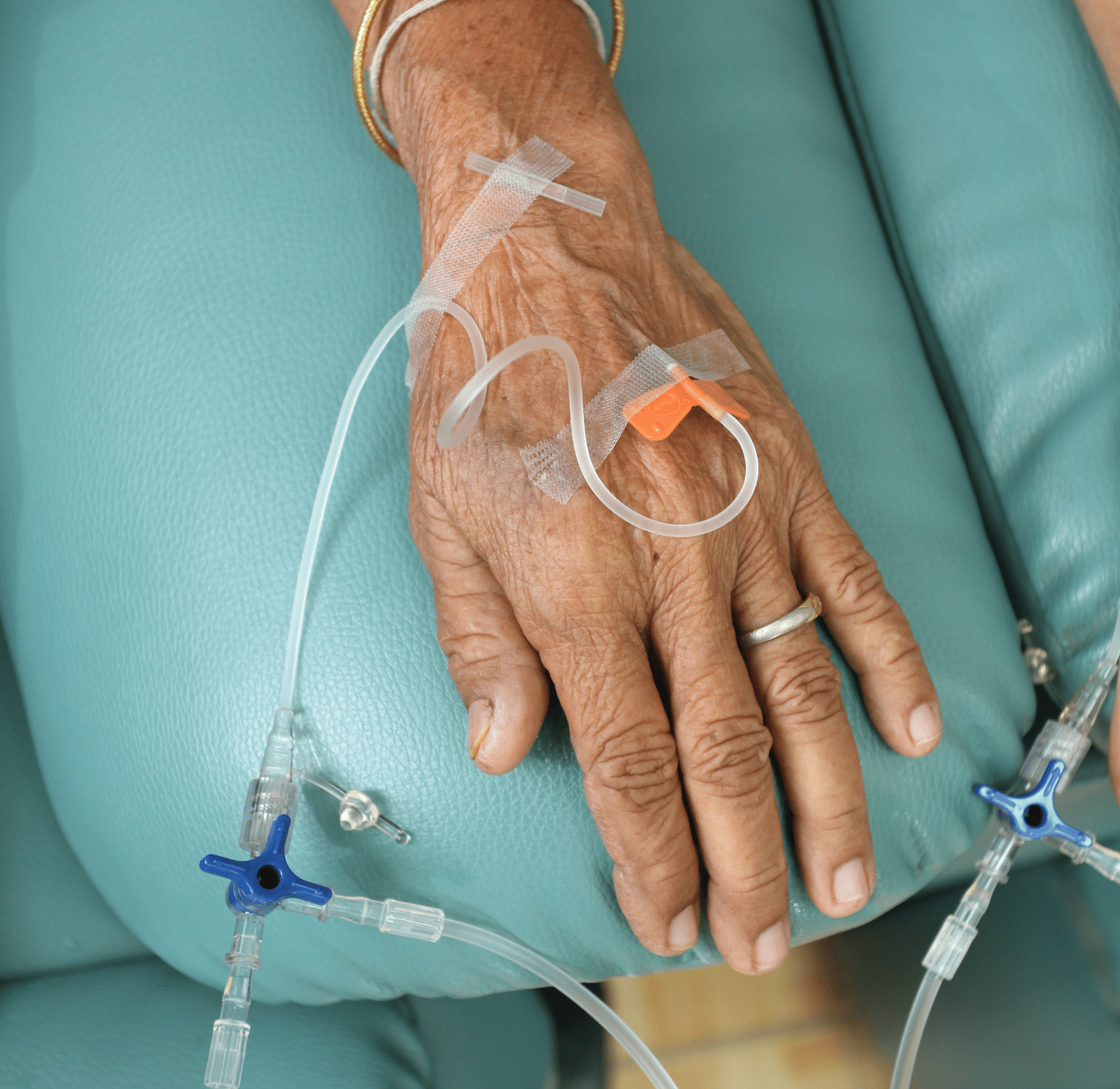 IV access via dorsal arch veins on the back of the hand
