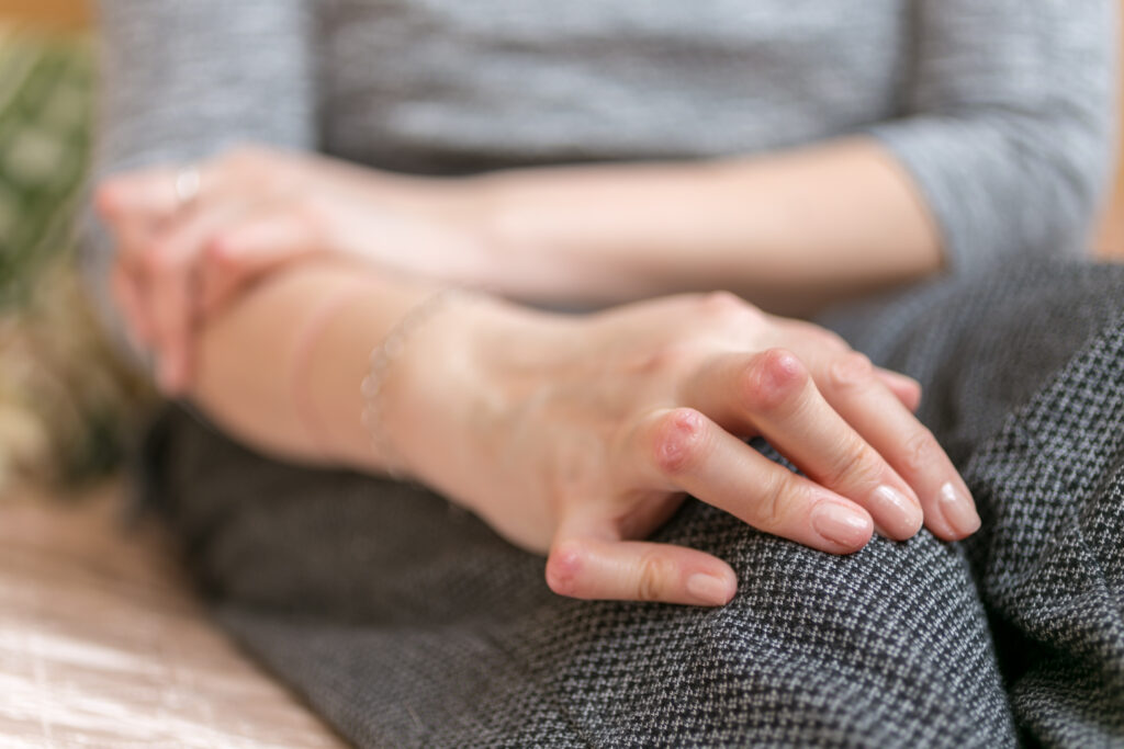 Young woman having rheumatoid arthritis takes a rest sitting on the couch.